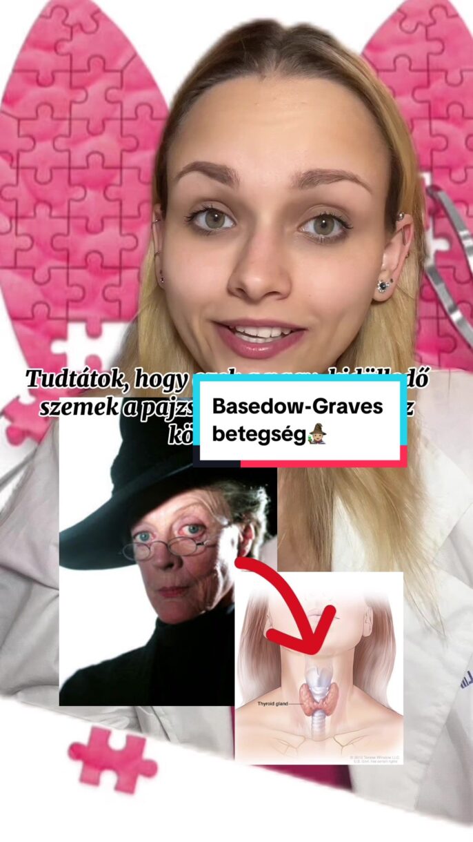 BASEDOW-GRAVES BETEGSÉG
